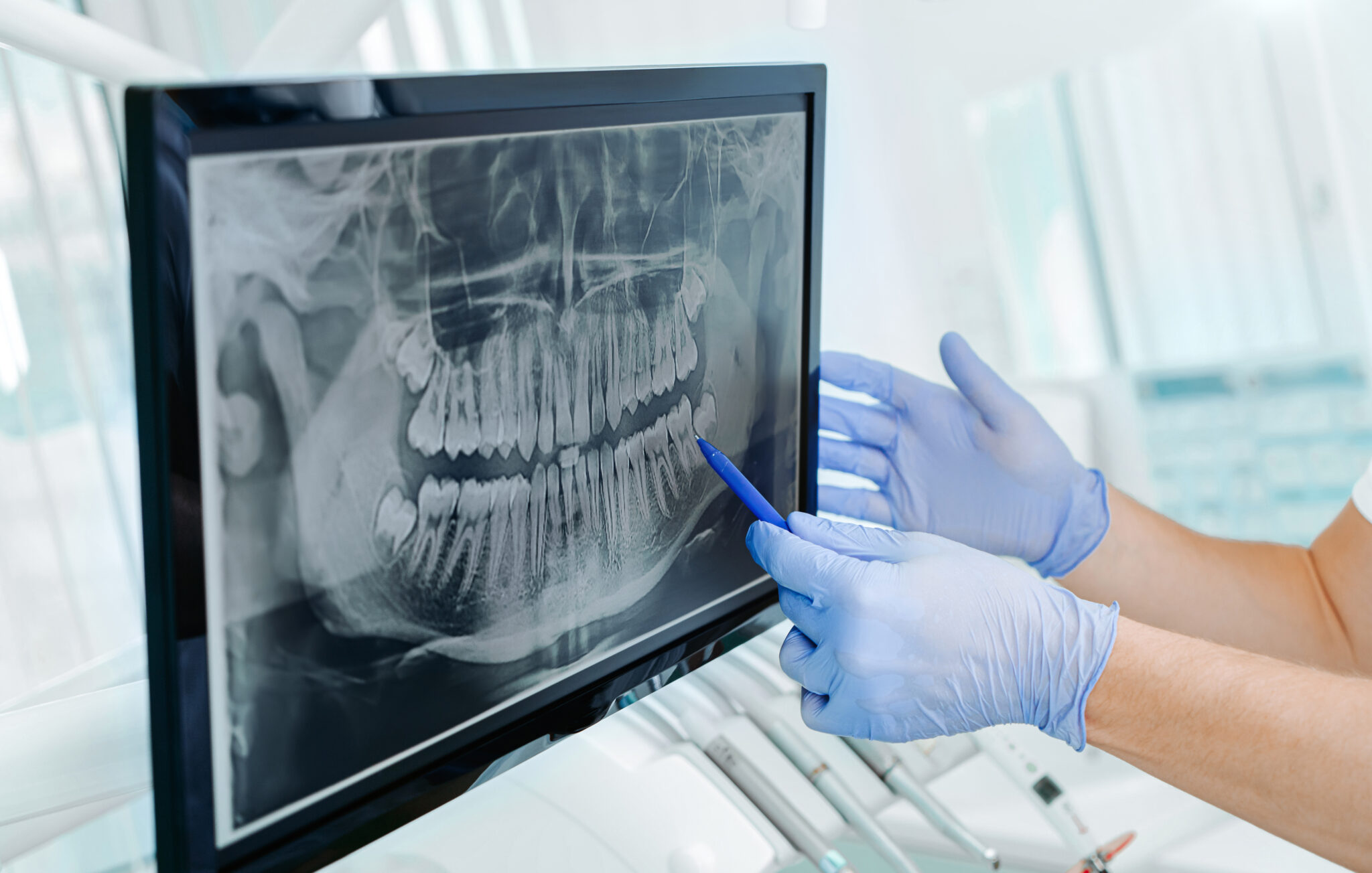 Digital X-Rays | La Amistad Dental Office