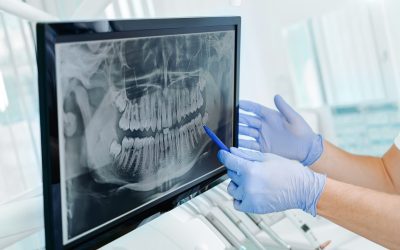 Hands doctor dentist in gloves show the teeth on x-ray on digital screen in dental clinic on light background with medical equipment. Smile healthy teeth concept, close up